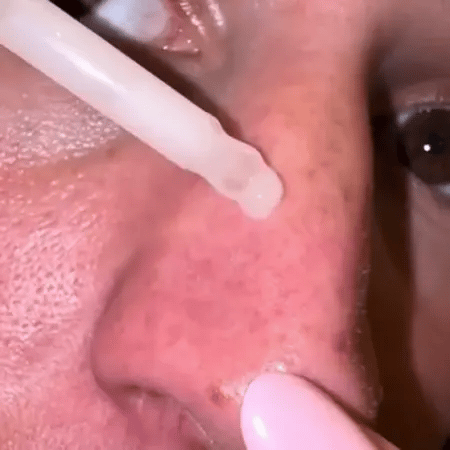 Dúo de Ampollas de Arroz Peel Shot Glow de Wowgood